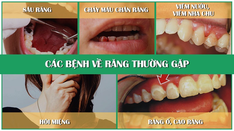 Bệnh lý răng miệng