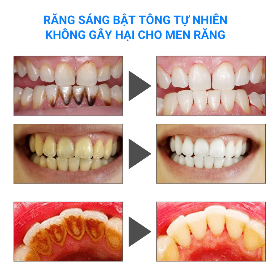 Không gây kích thích cho nướu
